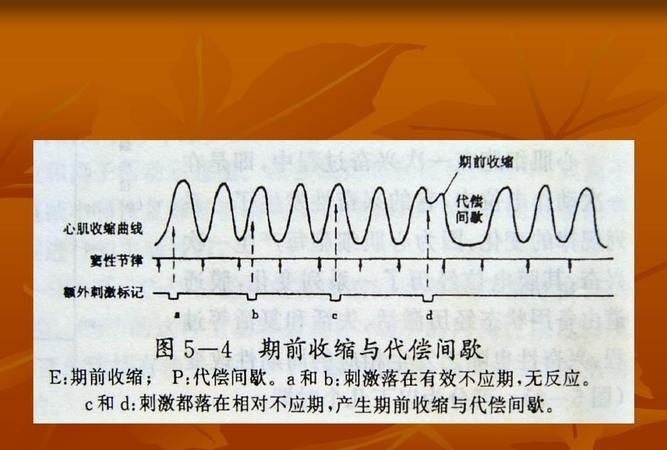 代偿 代偿是什么意思