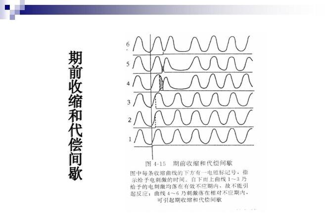 代偿 代偿是什么意思